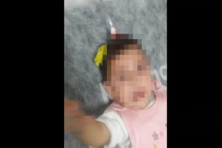 8 aylık bebeğin kafasına çatal saplandı