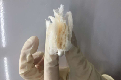 BTÜ'lü araştırmacılar o hastalığa çare oluyor