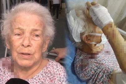 Sahibinden kaçan maymun dehşet saçtı!