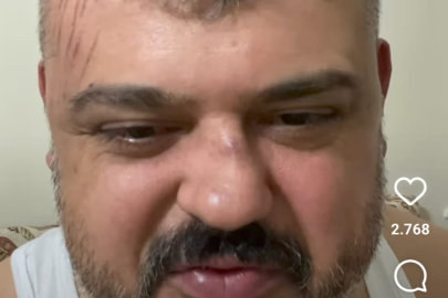 Fenomen Ahmet Adar dayak mı yedi?