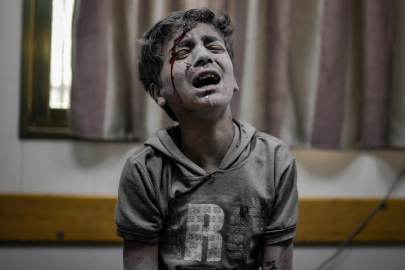 BM kuruluşları: Acil uluslararası eylem çağrısında bulunuyoruz