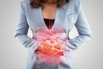 Kolon kanseri nedir? Belirtileri nelerdir? Genetik midir?