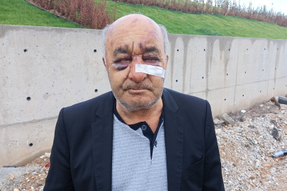 Taksiciyi öldüresiye dövüp, gasp edip kaçtı!