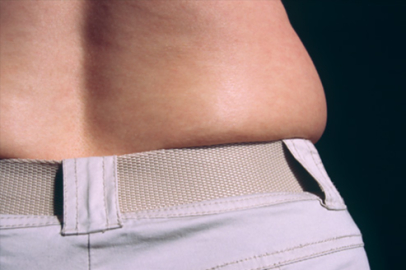 Bel bölgesindeki yağlar nasıl eritilir?