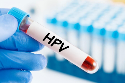 HPV virüsü olunca ne olur? HPV insana nasıl bulaşır?