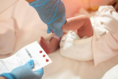 Bebeklerde hipotiroidi ihmale gelmiyor