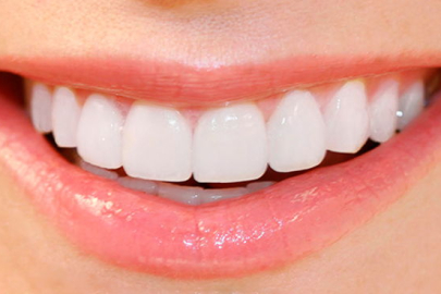 Sağlıklı bir insanın ağzında kaç diş bulunur?