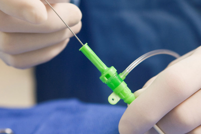 Anjiyo ameliyatı nedir? Anjiyo riskli bir ameliyat mı?