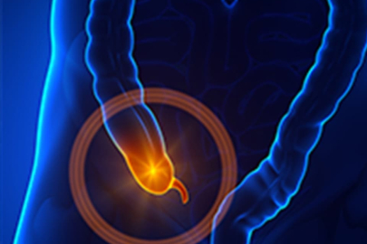 Apandisit ameliyatı nasıl yapılır, belirtileri nelerdir?
