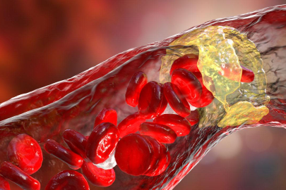 İyisiyle kötüsüyle kolesterol