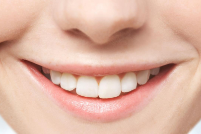 Diş eti hastalıkları bütün vücudu etkiliyor