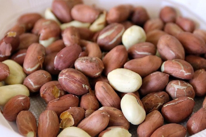 Yer fıstığı alerjisi erken tedaviyle önlenebilir