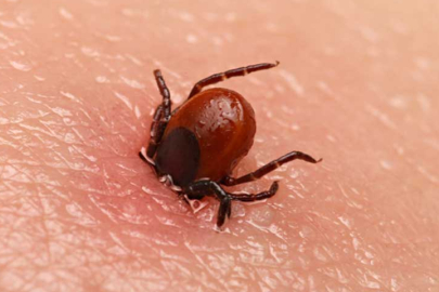 Kene ısırması sonrası ne yapmalı?