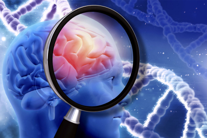 Genetik faktörler ve alzheimer riski: Ailenizden miras mı kalıyor?