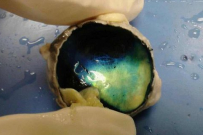 Tapetum Lucidum: Geceleri parlayan gözlerin gizemi