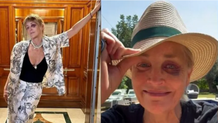 Paylaşımı korkuttu: Sharon Stone'nin gözü neden mor! Bursa Hayat Gazetesi -2
