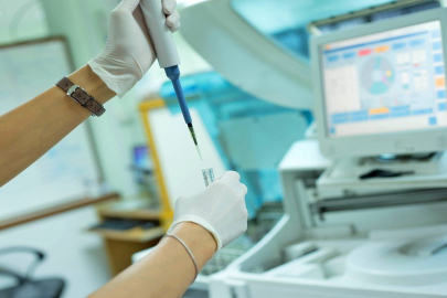 Kolonoskopi nedir, hangi durumlarda yapılır?