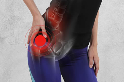 Avasküler Nekroz nedir?