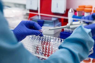 DNA örneği nedir ve nasıl alınır? DNA örneği alınması ve saklanması