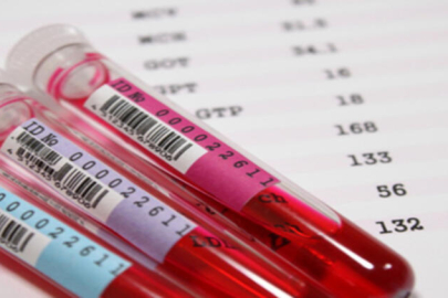 Bilim insanlarından yeni keşif! MAL kan grubu nedir?