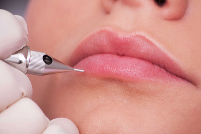 Dudak kontürü nedir ve neden yapılır?