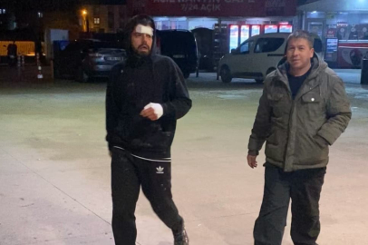 Önce bıçakladılar ardından tehdit edip telefonunu çaldılar