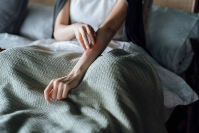 Egzama nedenleri ve tedavisi: Uzman isimden önemli açıklamalar