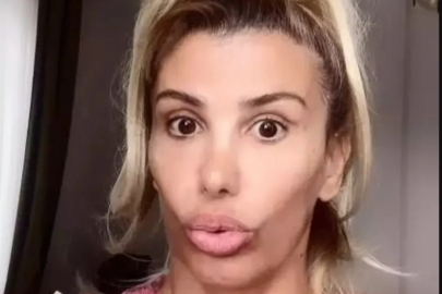 Hatice, botoks sonrası yaşadığı sağlık sorunlarını paylaştı