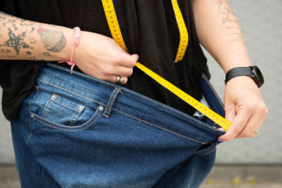 Obezite cerrahisinde yeni yaklaşımlar öne çıkıyor