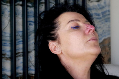 Bursa'da köpek saldırısında yaralandı, adalet peşinde!