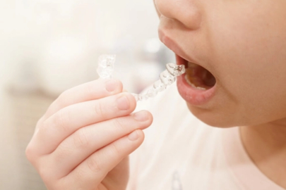 Şeffaf plaklarla çocuklara sağlıklı gülüşler