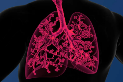 Uzmanından KOAH uyarısı: “Akciğer kaybı 3 kat artıyor”