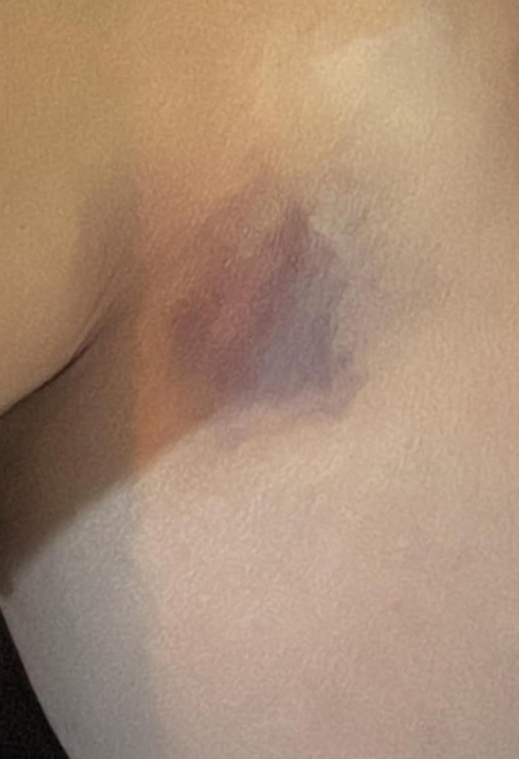 Ünlü oyuncudan şiddet paylaşımı! ‘Kocam tarafından darp edildim’ -Bursa Hayat-3