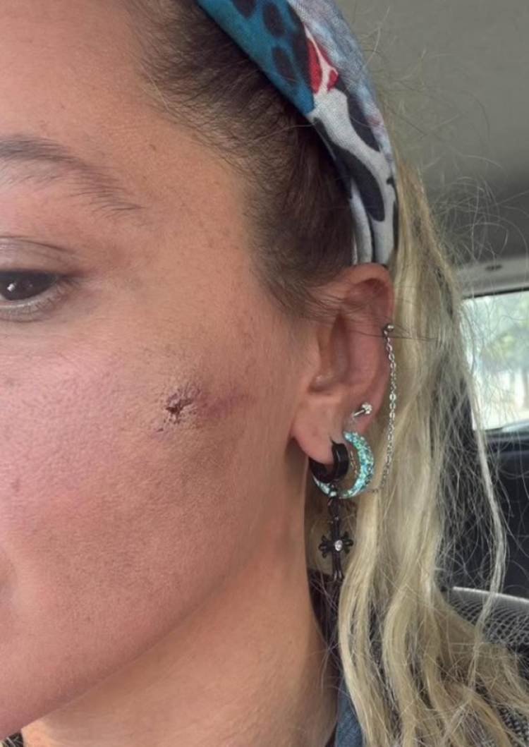 Ünlü oyuncudan şiddet paylaşımı! ‘Kocam tarafından darp edildim’ -Bursa Hayat-2