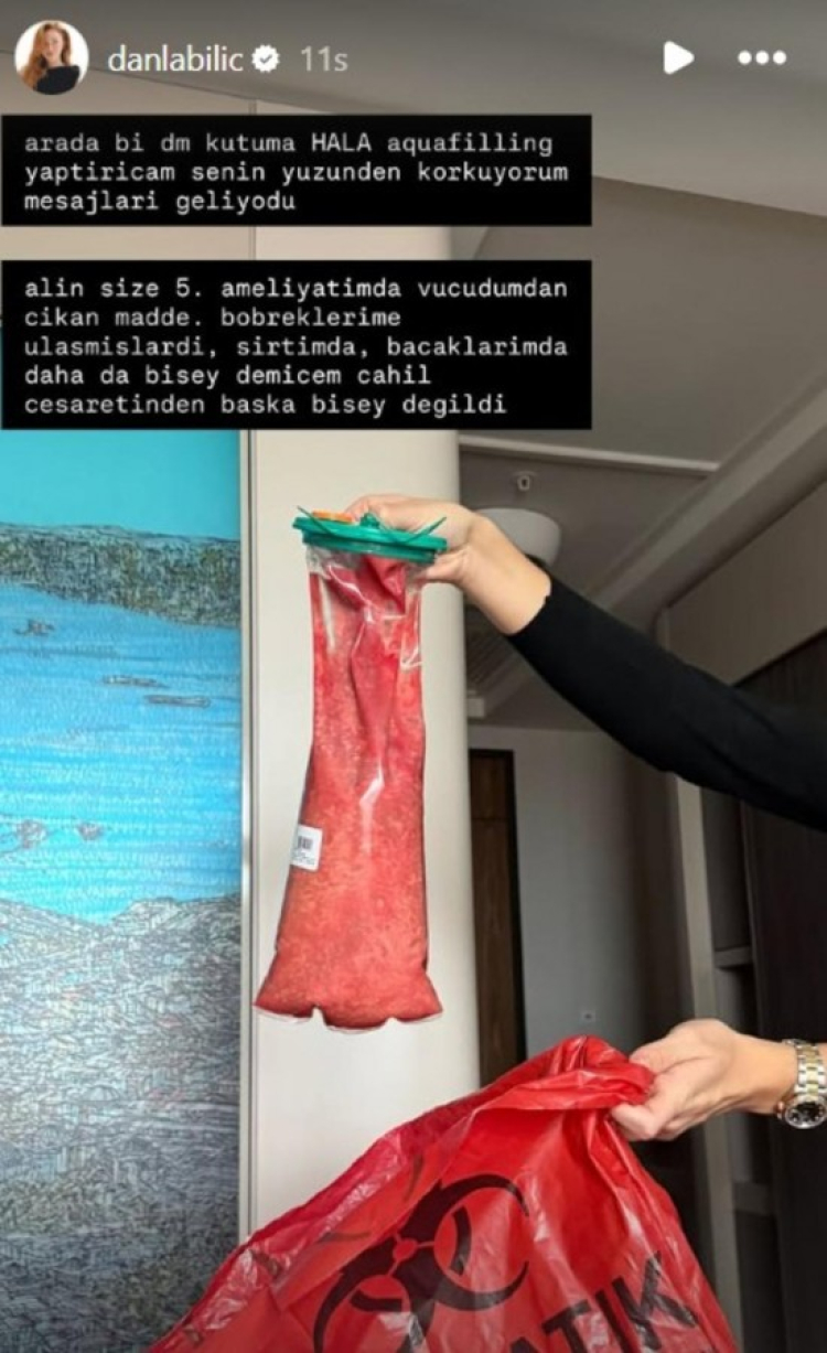 Ünlü fenomen ‘işte vücudumdan çıkan madde’ diyerek paylaştı! -Bursa Hayat-3