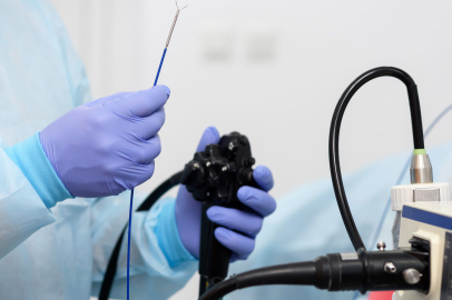 Uzmanı uyardı: "Gastroskopi hayat kurtaran bir yöntem"