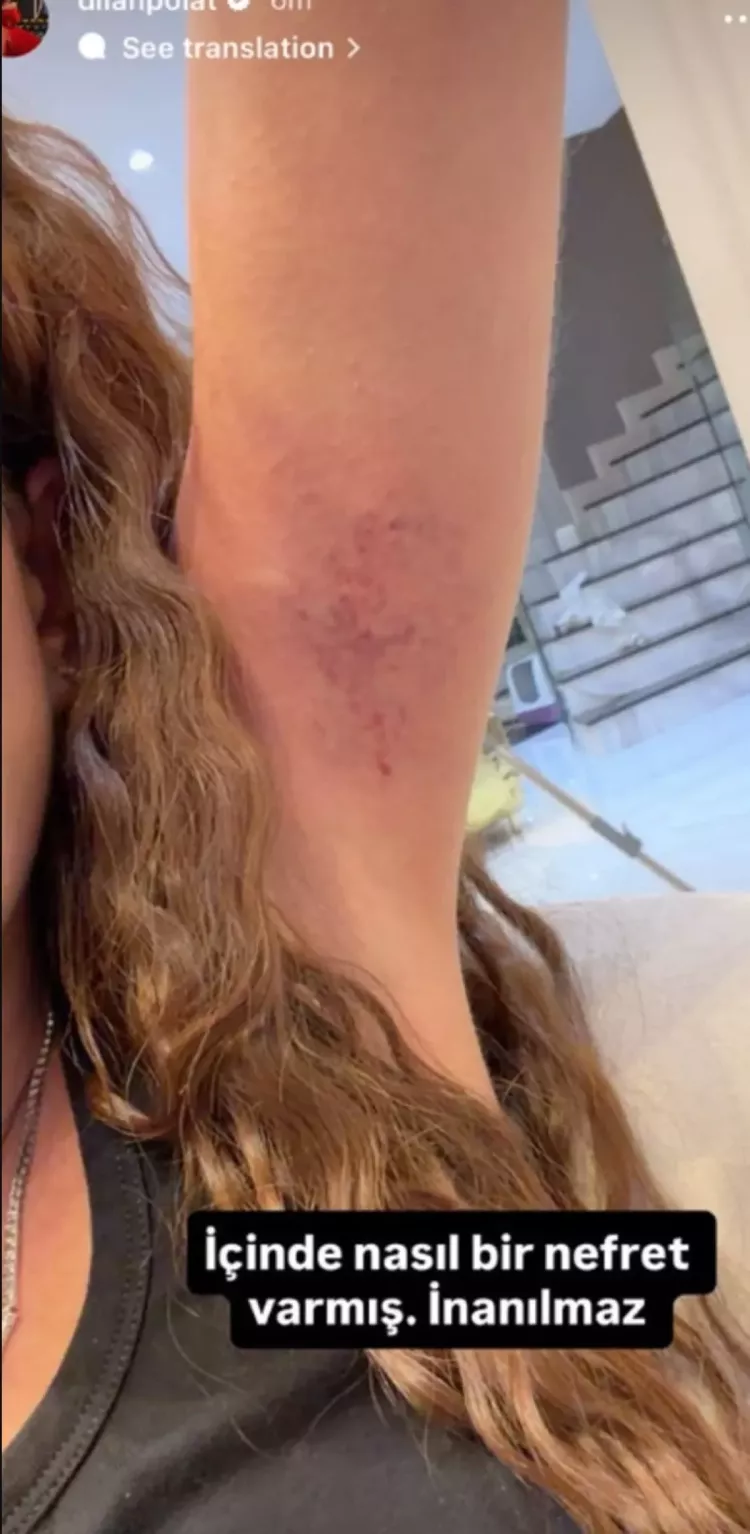 Fenomen kardeşler kavga etti: Dilan Polat sosyal medyada hesap sordu!-Bursa Hayat-4