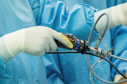 Omuz ağrılarına kapalı çözüm: Artroskopi ile aynı gün taburcu imkanı!