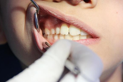 Uzmanından tatil döneminde çocukların diş sağlığına yönelik uyarılar!