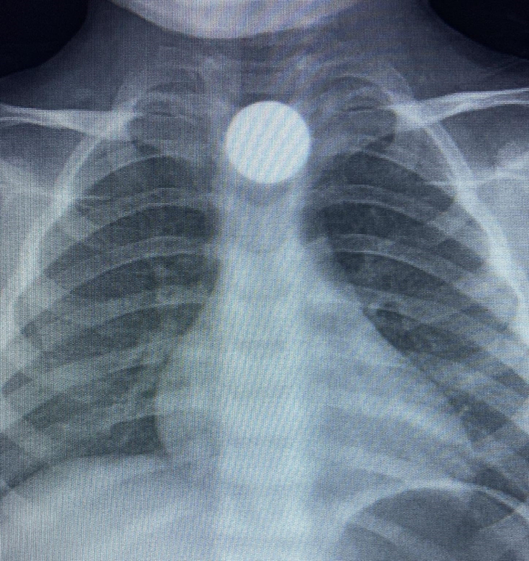 Bursa’da şoke eden olay: Hastaneye kaldırıldı!-Bursa Hayat-2