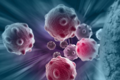 Doç. Dr. Ocak: ‘Kanserle mücadelede en güçlü silah erken tanı’