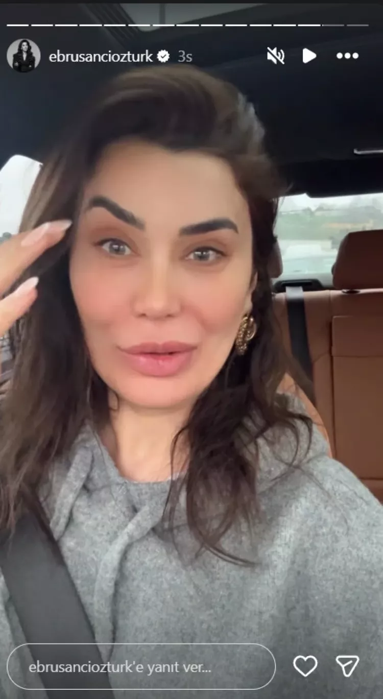 Ebru Şancı’nın botoks deneyimi sosyal medyayı salladı!-Bursa Hayat-2