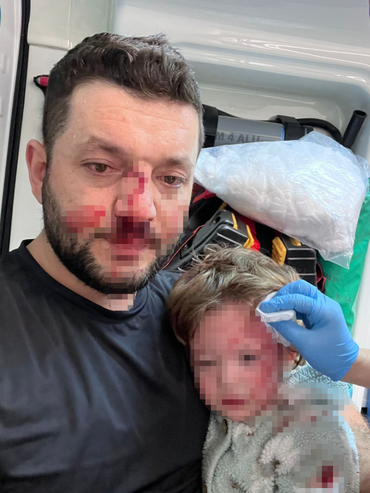 Yalova’da dehşet: 14 aylık bebeğin kafatası çatladı!-Bursa Hayat-2