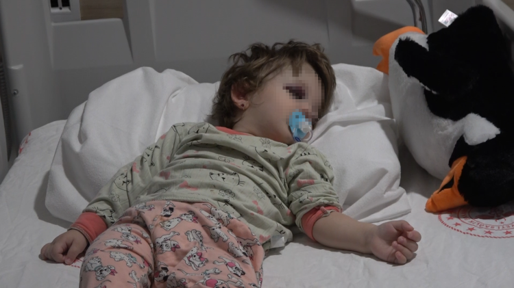 Yalova’da dehşet: 14 aylık bebeğin kafatası çatladı!-Bursa Hayat-3