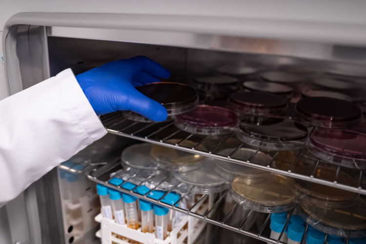 SBÜ’den kişiye özel probiyotikler: Bağırsaktan sağlığa özel çözümler!-Bursa Hayat-4