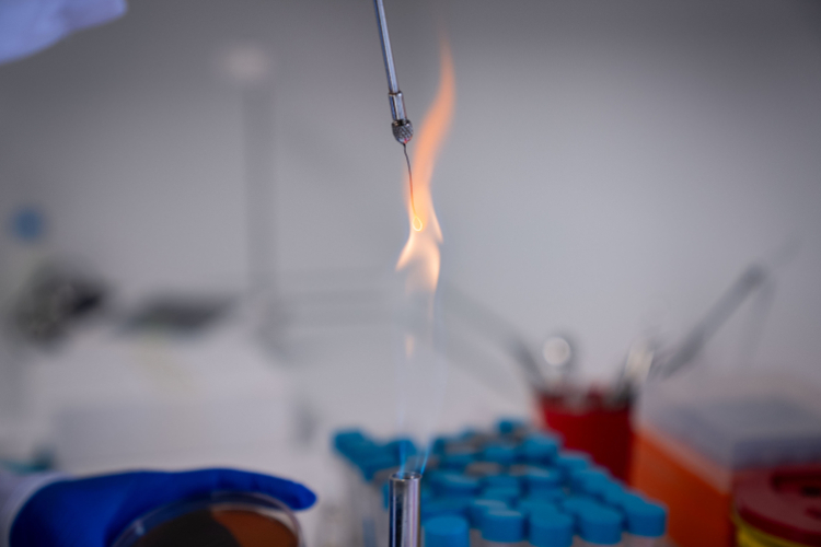 SBÜ’den kişiye özel probiyotikler: Bağırsaktan sağlığa özel çözümler!-Bursa Hayat-3