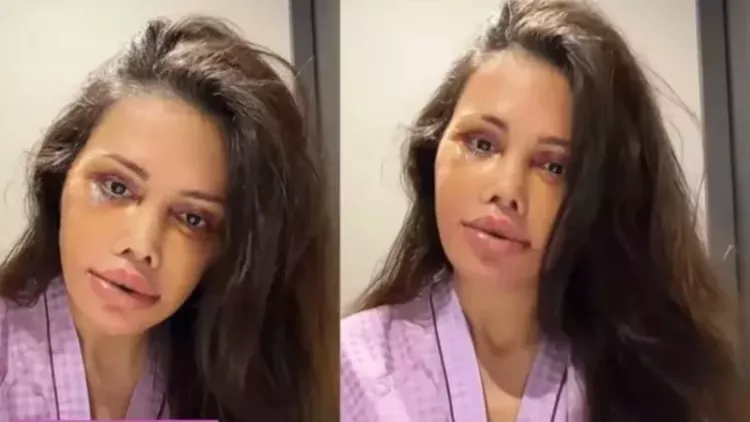 Güney Kore’de yüz nakli sonrası şok haber: Didem Ceran kanserle mücadelede!-Bursa Hayat-2