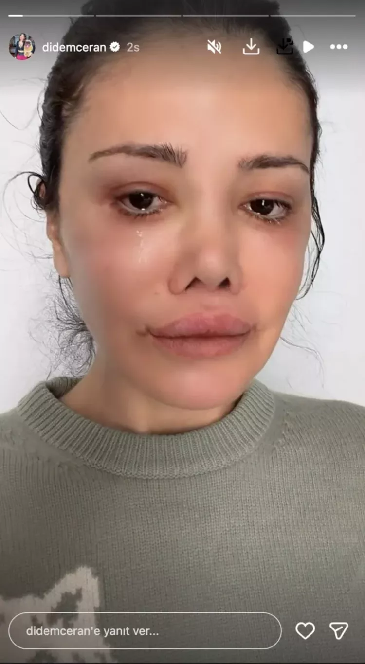 Güney Kore’de yüz nakli sonrası şok haber: Didem Ceran kanserle mücadelede!-Bursa Hayat-3