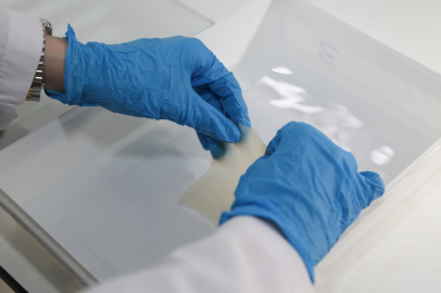 BTÜ’den diş tedavilerinde ithal ürünlere yerli alternatif