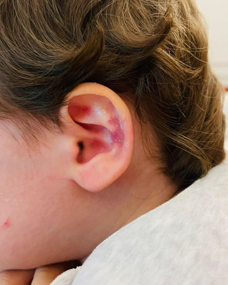 Bursa’da kreşte şiddet ve ihmal iddiası: Aile savcılığa başvurdu - Bursa Hayat Gazetesi-3